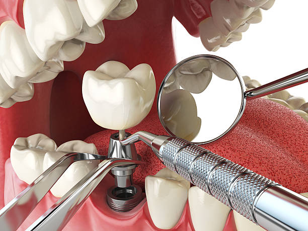 Emergency Dentist Open Today in CA